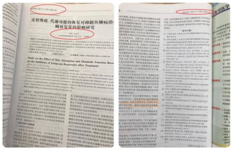 Kaiyun中国：从“树皮娃娃”到国际认证：张建疗法论文获国家级期刊(图2)